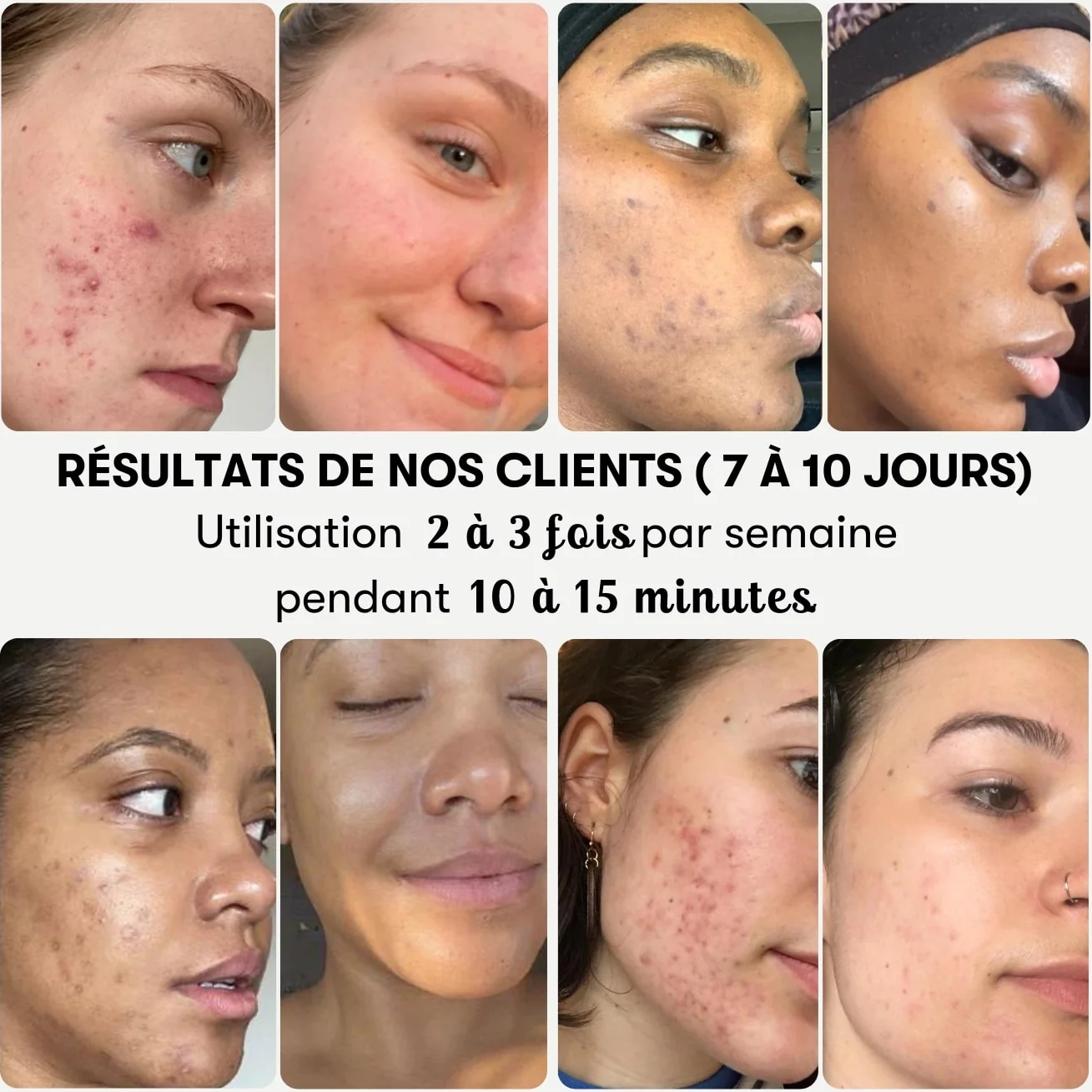 Masque Curcuma - L'éclat naturel, une peau dorée de beauté